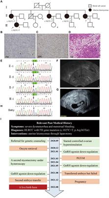 Case report: A healthy baby achieved after preimplantation genetic testing from an infertile woman with hereditary leiomyomatosis and renal cell cancer syndrome